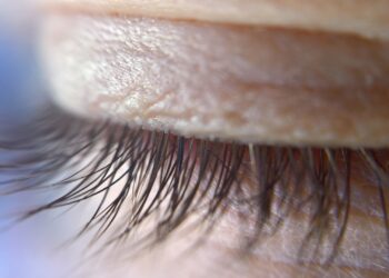 Powieki z problemami